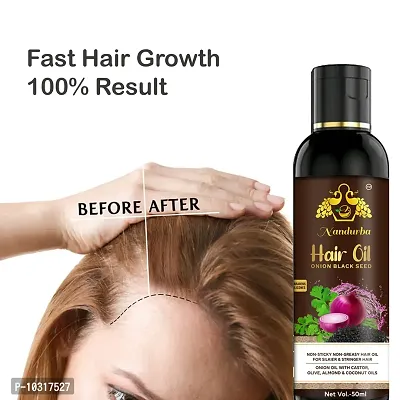 Herbal Red Onion Oil For Hair Growth Anti Hair Fall Hair Oil 50 Ml-thumb0