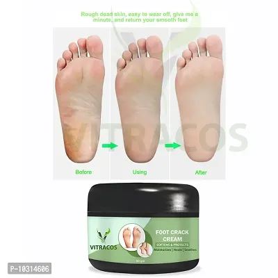 Foot Crack Cream For Dry Cracked Heels And Feet 50 Gm-thumb0