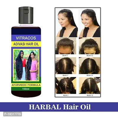 Medicine Hair Oil With Comb Applicator 100 Ml For Women And Men For Hair Long - Dandruff Control Hair Loss Control - Long Hair - Hair Regrowth Hair Oil 100 % Ayurvedic- 100 Ml-thumb0