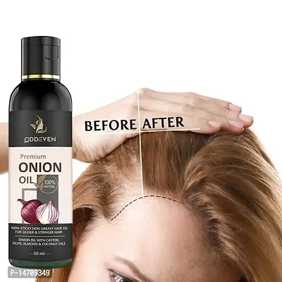 Onion Fast Hair Growth Oil - With Comb Applicator ONION HAIR OIL (50ML) (PACK OF 1)