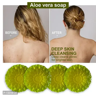 Moisturizing Aloe Vera Soap For Long-Lasting Hydration-100 Grams Each, Pack Of 4-thumb0