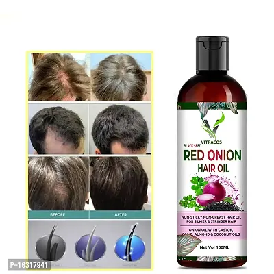 Organics Onion Black Seed Hair Oil - With Comb Applicator - Controls Hair Fall - No Mineral Oil, Silicones, Cooking Oil And Synthetic Fragrance Hair Oil- 100 Ml