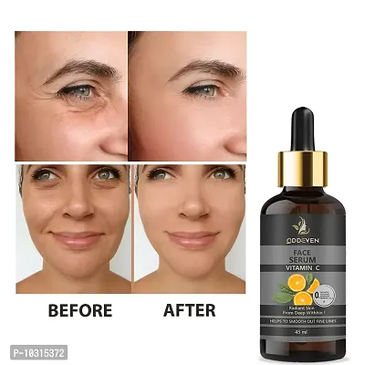 Vitamin C Serum For Face Pigmentation And Oily Skin-thumb0