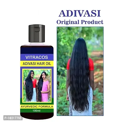 Herbal Hair Growth Oil For Regrowth- 100 Ml-thumb0