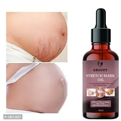 Stretch Marks Oil Soothing Scar And Stretch Mark Removal Oil Pregnancy And Postpartum Safe All-Natural, Paraben-Free 40 Ml-thumb0