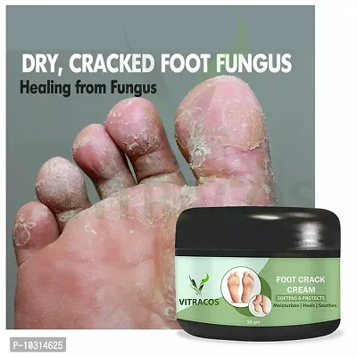 Foot Care Cream For Rough, Feet Cream For Heel Repair Healing And Softening Cream 50 Grams-thumb0