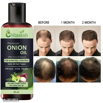 Onion Black Seed Hair Oil 50Ml For Man And Women-thumb0