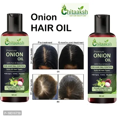 Onion Oil For Hair Regrowth And Hair Fall Control Hair Oil 50 Ml Pack Of 2-thumb0