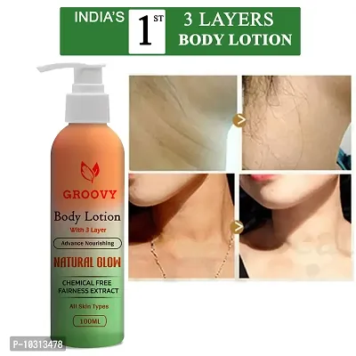 Whitening Lotion Prevents Bum Acne Parabens And Minerals Free- 100 Ml-thumb0