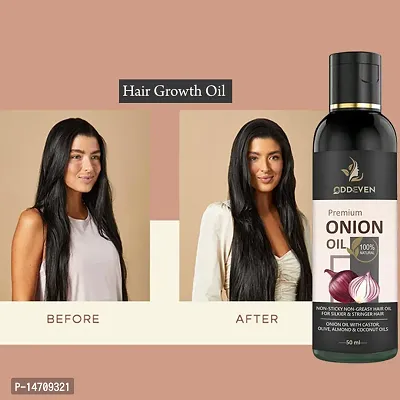 Red Onion Black Seed Hair Oil For Fast Hair Growth  ONION HAIR OIL (50ML) (PACK OF 1) Pack of 1