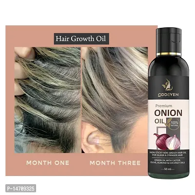 Onion Hair Oil For Hair Growth Hair oilnbsp; ONION HAIR OIL (50ML) (PACK OF 1)