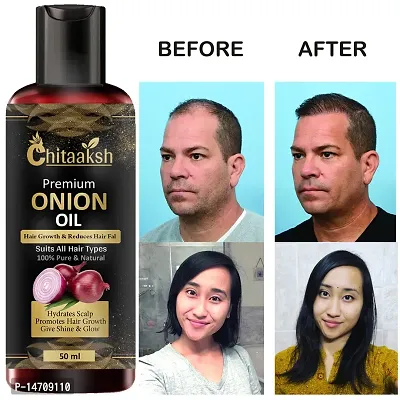 Onion Hair Oil For Hair Growth  Anti Dandruff Oil (50ml) Pack of 1.
