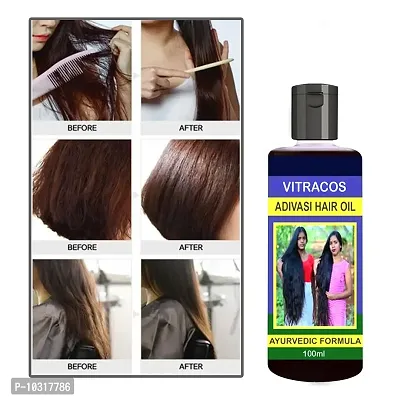 Hair Fall Controll, Hair Growth, Long Hair Aryuvedic Oil 100 ml-thumb0