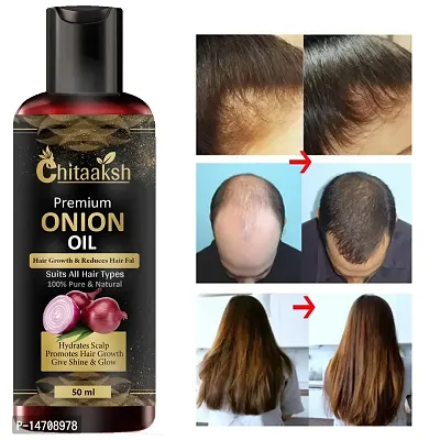 Hair Oil 7 Day Challenge for Hair growth (Pack of 1) for man and woman.-thumb0