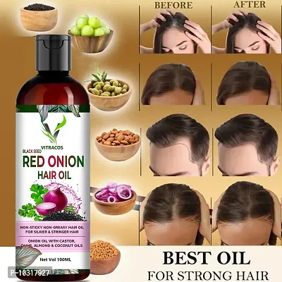 Professionals Onion Hair Oil With Vitamin E Oil For Hair Fall Control With Hair Oil Applicator Natural Oil, Green Tea For Hair Fall Control - 100 Ml Hair Oil- 100 Ml-thumb0