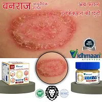 Kf Krishnam Vidhmaan Ayurveda Vanraj Anti fungal Malam = for Ringworm, itching, Eczema & Fungal Infection. (Pack Of 1)-thumb3