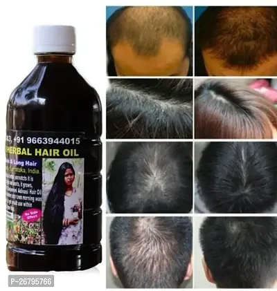 Adivasi Yurvedic Strong Roots Oil, Privents Hair Fall Good For Hair Growth Hair Oil(100 Ml)-thumb0