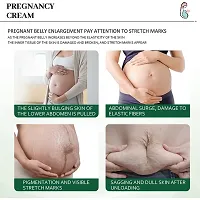 KURAIY Pregnancy Scars Remove Stretch Marks Cream Treatment Maternity Repair Anti-Aging Anti-Wrinkles Firming Stretch Mark Body Cream-thumb1