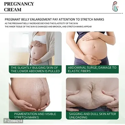 KURAIY Pregnancy Scars Remove Stretch Marks Cream Treatment Maternity Repair Anti-Aging Anti-Wrinkles Firming Stretch Mark Body Cream-thumb2