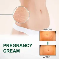 KURAIY Pregnancy Scars Remove Stretch Marks Cream Treatment Maternity Repair Anti-Aging Anti-Wrinkles Firming Stretch Mark Body Cream-thumb3