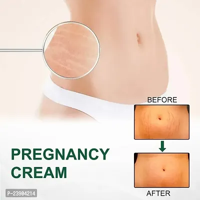 KURAIY Pregnancy Scars Remove Stretch Marks Cream Treatment Maternity Repair Anti-Aging Anti-Wrinkles Firming Stretch Mark Body Cream-thumb4