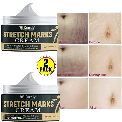 KURAIY Remove Pregnancy Scars Acne Cream Stretch Marks Treatment Maternity Repair Anti-Aging (PACK OF 2)