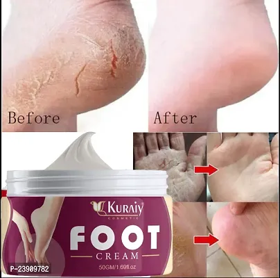 KURAIY 100% Foot corn remover Cream , for dry hard cracked heel skin repair / swelling  pain relief / feet care men and women.