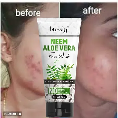 KURAIY 100% Premium NEEM ALOE VERA Facial Cleanser Face Washing Remove Blackhead Face wash