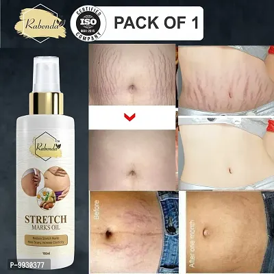 Trendy Present Repair Stretch Marks Removal - Natural Heal Pregnancy Breast, Hip, Legs, Mark Oil 100 Ml Pack Of 1-thumb0