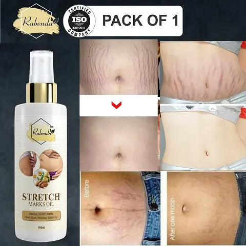 Must Have Anti-stretch Mark Creams 