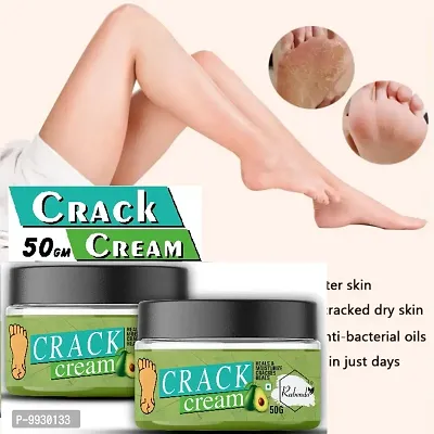 Trendy Foot Care Cream For Rough, Dry And Cracked Heel-Feet Cream For Heel Repair-Healing And Softening Cream