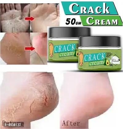 Trendy Foot Care Cream For Rough, Dry And Cracked Heel-Feet Cream For Heel Repair-Healing And Softening Cream