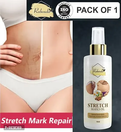 Trendy Present Repair Stretch Marks Removal - Natural Heal Pregnancy Breast, Hip, Legs, Mark Oil 100 Ml Pack Of 1