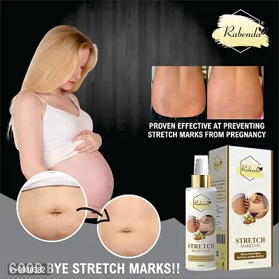 Trendy Present Repair Stretch Marks Removal - Natural Heal Pregnancy Breast, Hip, Legs, Mark Oil 100 Ml Pack Of 2-thumb2