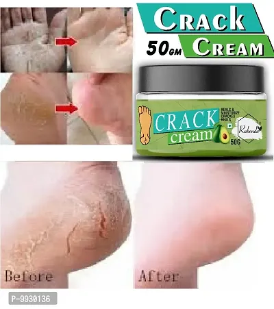 Trendy Foot Care Cream For Rough, Dry And Cracked Heel-Feet Cream For Heel Repair-Healing And Softening Cream