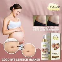 Trendy Present Repair Stretch Marks Removal - Natural Heal Pregnancy Breast, Hip, Legs, Mark Oil 100 Ml Pack Of 1-thumb1