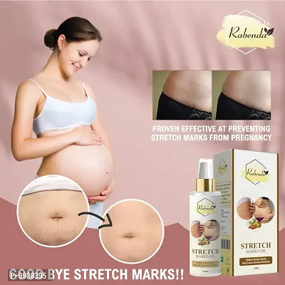 Trendy Present Repair Stretch Marks Removal - Natural Heal Pregnancy Breast, Hip, Legs, Mark Oil 100 Ml Pack Of 1-thumb2