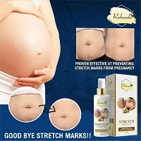 Trendy Present Repair Stretch Marks Removal - Natural Heal Pregnancy Breast, Hip, Legs, Mark Oil 100 Ml Pack Of 2-thumb1