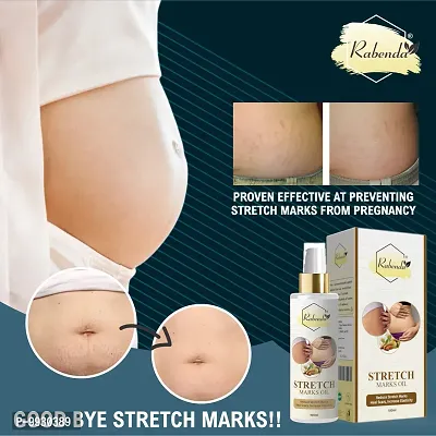 Trendy Present Repair Stretch Marks Removal - Natural Heal Pregnancy Breast, Hip, Legs, Mark Oil 100 Ml Pack Of 1-thumb2