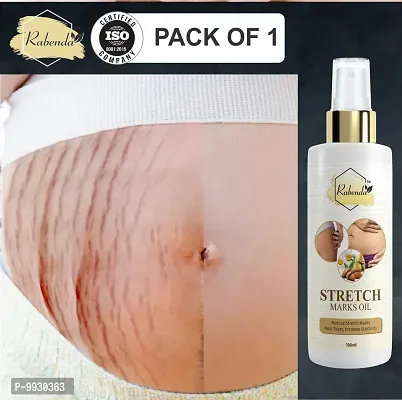 Trendy Present Repair Stretch Marks Removal - Natural Heal Pregnancy Breast, Hip, Legs, Mark Oil 100 Ml Pack Of 1-thumb0