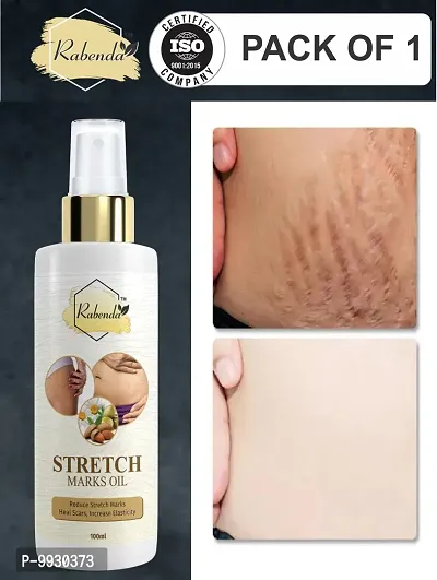 Trendy Present Repair Stretch Marks Removal - Natural Heal Pregnancy Breast, Hip, Legs, Mark Oil 100 Ml Pack Of 1