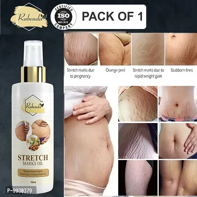 Trendy Present Repair Stretch Marks Removal - Natural Heal Pregnancy Breast, Hip, Legs, Mark Oil 100 Ml Pack Of 1