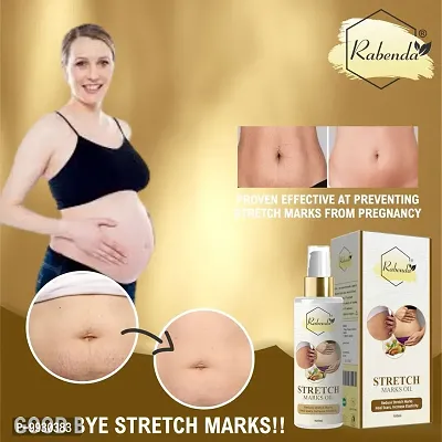 Trendy Present Repair Stretch Marks Removal - Natural Heal Pregnancy Breast, Hip, Legs, Mark Oil 100 Ml Pack Of 1-thumb2