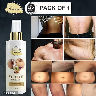 Trendy Present Repair Stretch Marks Removal - Natural Heal Pregnancy Breast, Hip, Legs, Mark Oil 100 Ml Pack Of 1