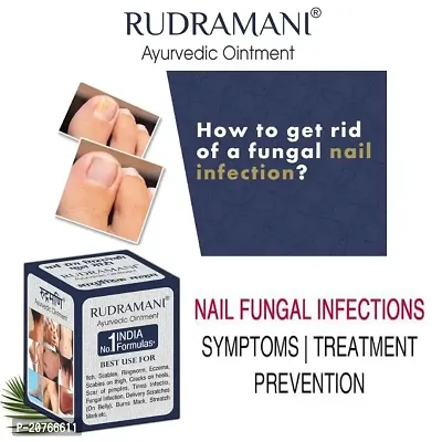Rudramani Ayurvedic  Malam For Dad Khaj Khujli Anti Skin fungal Infection, itching, Skin Tretment, Ringworm, Eczema, Foot Crack Care, Skin Care Cream 25 G