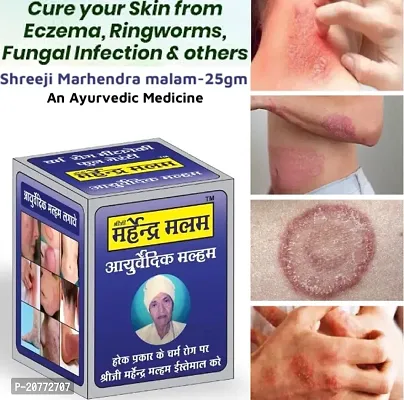 Shreeji Marhendra Ayurvedic Marham Malam For Anti Skin fungal Infection, itching, Skin Tretment, Ringworm, Eczema, Burn Mark, Scabies, Foot Crack Care, Skin Care Cream Ointment 25GR-thumb2