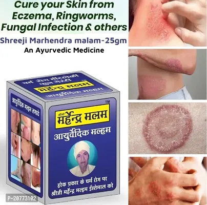 Shreeji Marhendra Malam For Dad Khaj Khujali  Ointment  Skin fungal Infection, Skin Care, itching, Skin Tretment, Ringworm, Eczema, Scabies  25 GR-thumb0