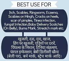 Shreeji Marhendra Ayurvedic  Malam For Ant Dad Khaj Khujali Cream, Skin Fungal Infection, itching Cream, Skin Tretment, Ringworm, Eczema, Burn Mark,  Foot Crack Care, Skin Care Cream  25G-thumb1