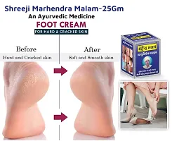 Shreeji Marhendra Itching Malam For Fungal Infection, Skin Treatment, Eczema, Ringworm 25 G-thumb1