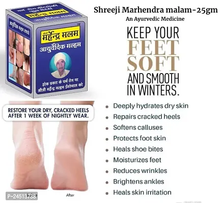 Shreeji Marhendra Itching Malam For Fungal Infection, Skin Treatment, Eczema, Ringworm 25 G-thumb4